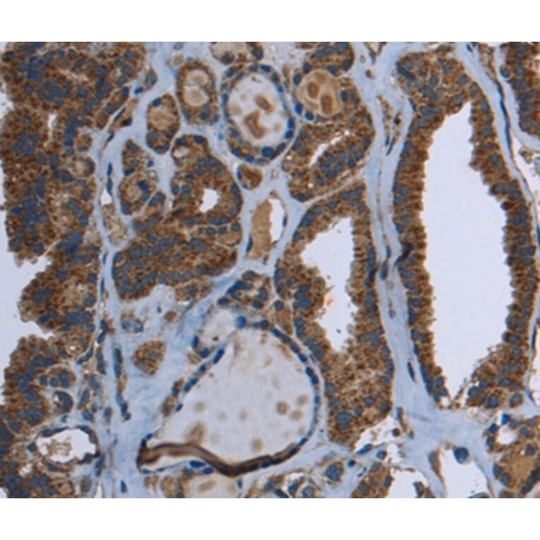Immunohistochemistry - GCK Antibody from Signalway Antibody (36499) - Antibodies.com