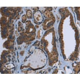 Immunohistochemistry - GCK Antibody from Signalway Antibody (36499) - Antibodies.com