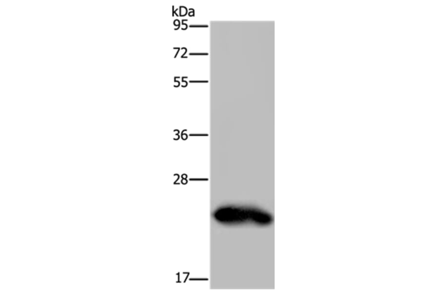 GH2 Antibody from Signalway Antibody (36502) - Antibodies.com