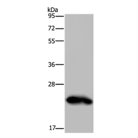 GH2 Antibody from Signalway Antibody (36502) - Antibodies.com