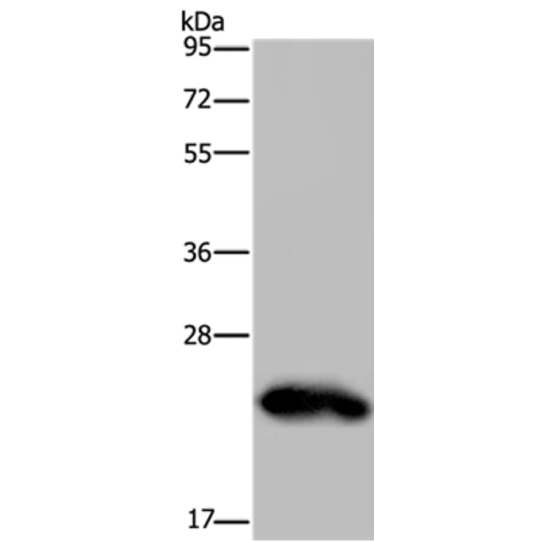 GH2 Antibody from Signalway Antibody (36502) - Antibodies.com