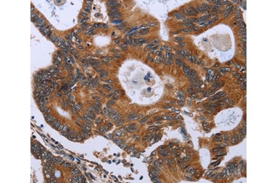 Immunohistochemistry - GH2 Antibody from Signalway Antibody (36502) - Antibodies.com