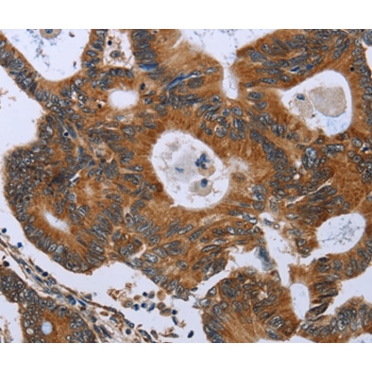 Immunohistochemistry - GH2 Antibody from Signalway Antibody (36502) - Antibodies.com