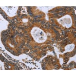 Immunohistochemistry - GH2 Antibody from Signalway Antibody (36502) - Antibodies.com