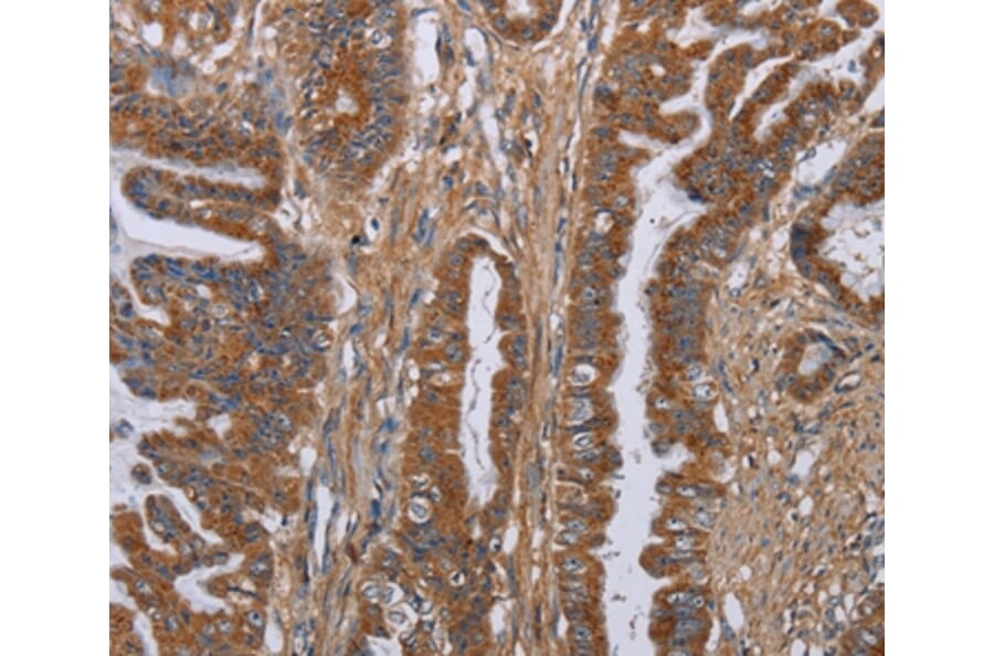 Immunohistochemistry - LUM Antibody from Signalway Antibody (36591) - Antibodies.com