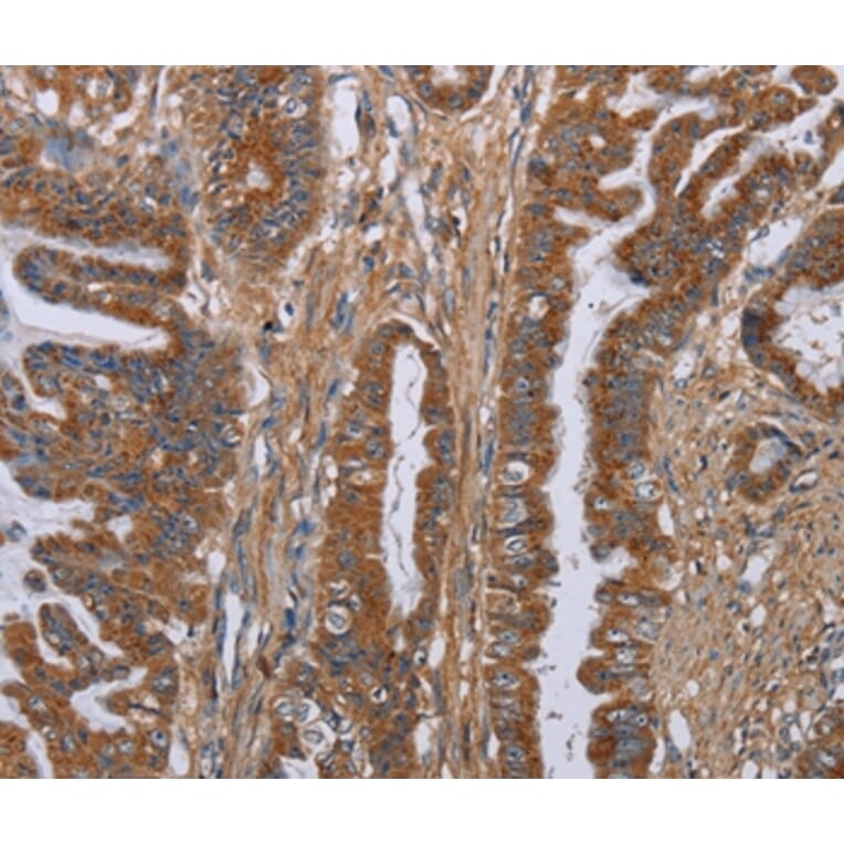 Immunohistochemistry - LUM Antibody from Signalway Antibody (36591) - Antibodies.com