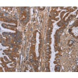 Immunohistochemistry - LUM Antibody from Signalway Antibody (36591) - Antibodies.com