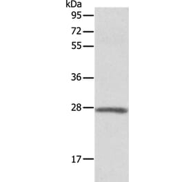 ADM Antibody from Signalway Antibody (36726) - Antibodies.com