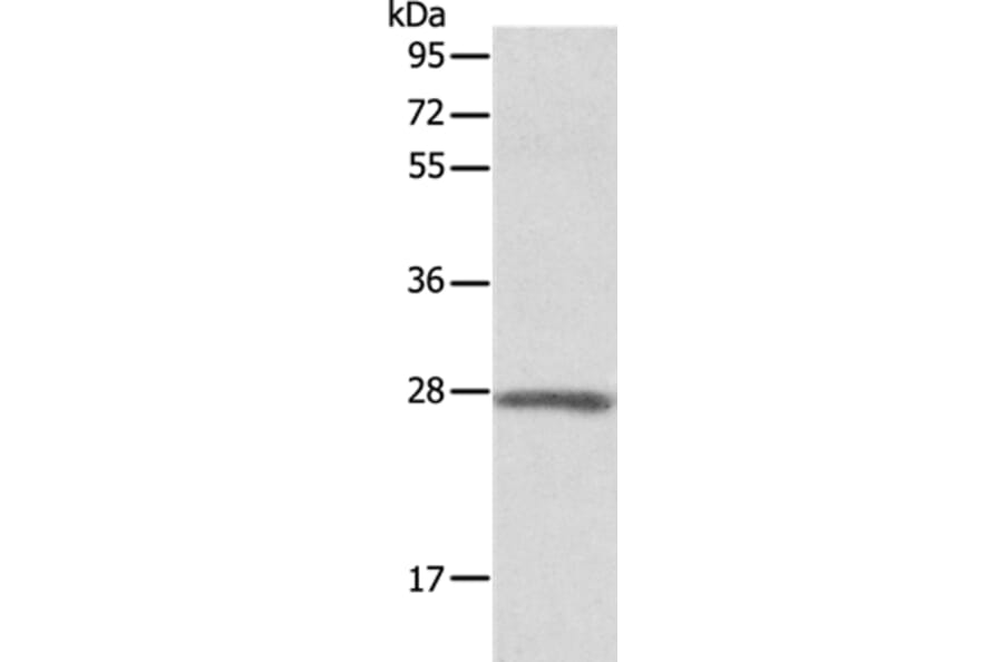 ADM Antibody from Signalway Antibody (36726) - Antibodies.com