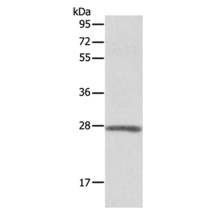 ADM Antibody from Signalway Antibody (36726) - Antibodies.com