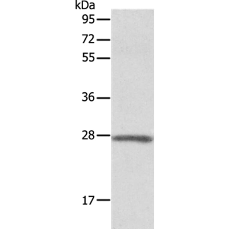 ADM Antibody from Signalway Antibody (36726) - Antibodies.com