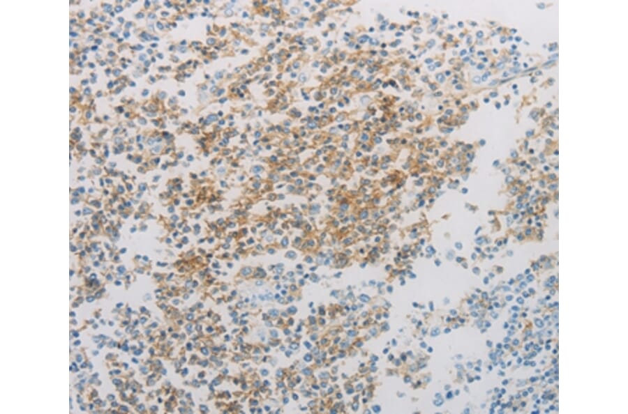 Immunohistochemistry - ADM Antibody from Signalway Antibody (36726) - Antibodies.com
