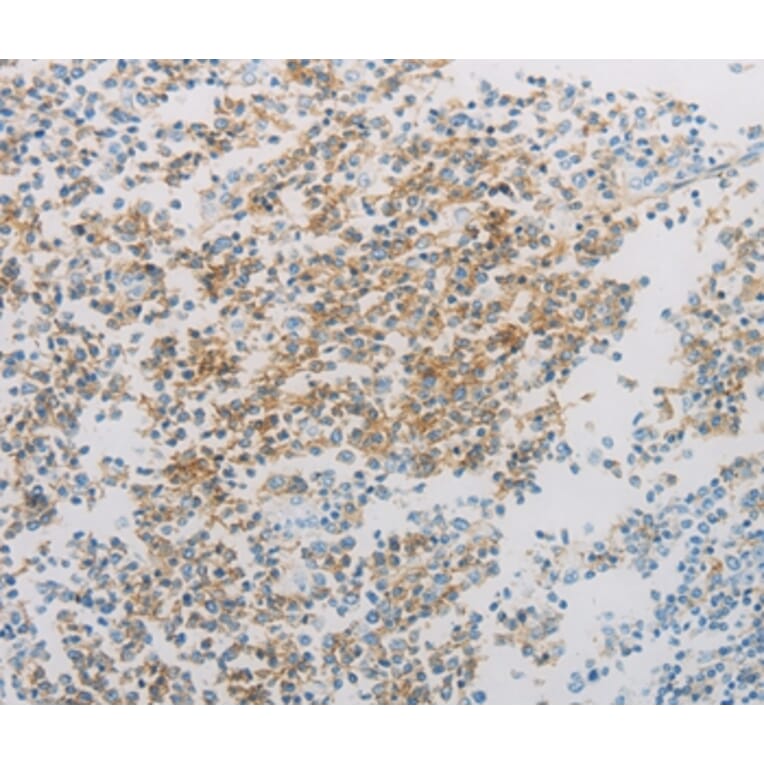 Immunohistochemistry - ADM Antibody from Signalway Antibody (36726) - Antibodies.com