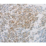 Immunohistochemistry - ADM Antibody from Signalway Antibody (36726) - Antibodies.com