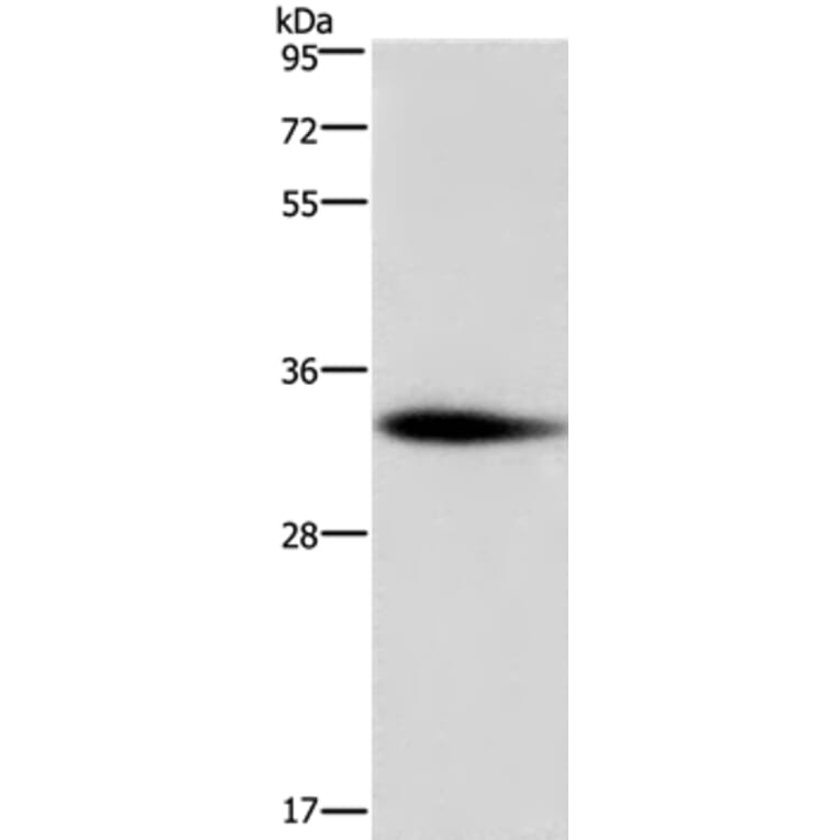 ADO Antibody from Signalway Antibody (36728) - Antibodies.com