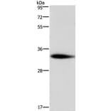ADO Antibody from Signalway Antibody (36728) - Antibodies.com