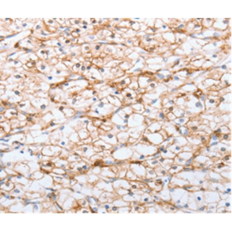 Immunohistochemistry - ADO Antibody from Signalway Antibody (36728) - Antibodies.com
