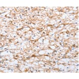 Immunohistochemistry - ADO Antibody from Signalway Antibody (36728) - Antibodies.com