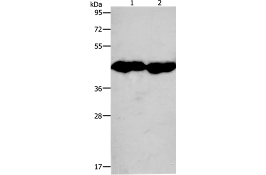 CKM Antibody from Signalway Antibody (36750) - Antibodies.com