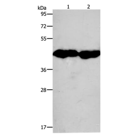 CKM Antibody from Signalway Antibody (36750) - Antibodies.com