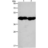 CKM Antibody from Signalway Antibody (36750) - Antibodies.com