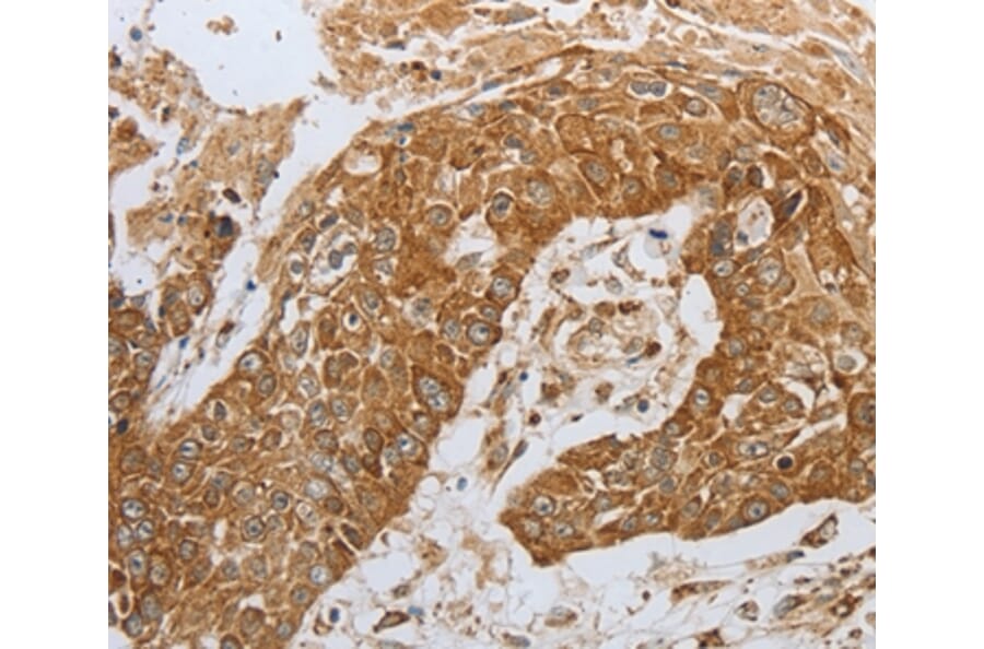 Immunohistochemistry - CKM Antibody from Signalway Antibody (36750) - Antibodies.com
