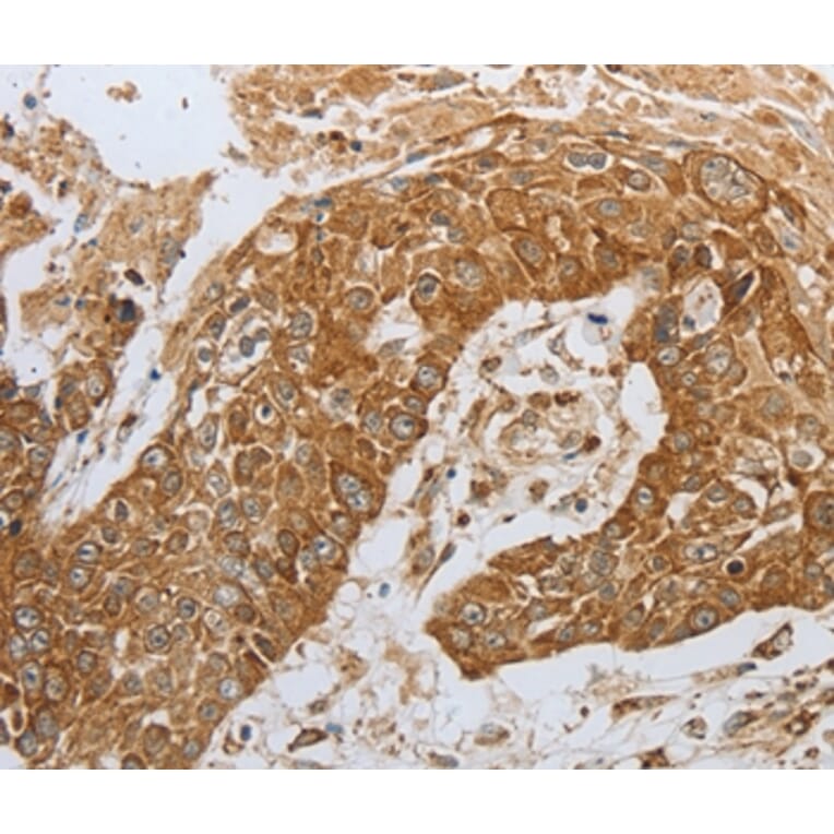 Immunohistochemistry - CKM Antibody from Signalway Antibody (36750) - Antibodies.com