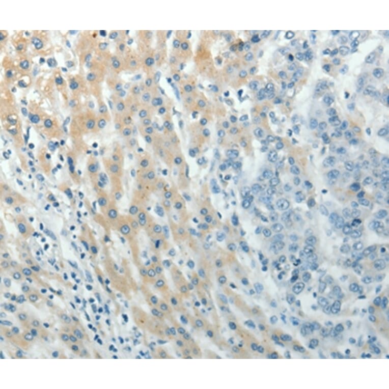 Immunohistochemistry - PXN Antibody from Signalway Antibody (37012) - Antibodies.com