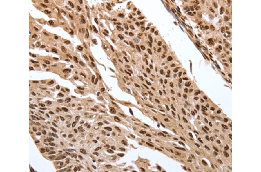 Immunohistochemistry - SRF Antibody from Signalway Antibody (37042) - Antibodies.com