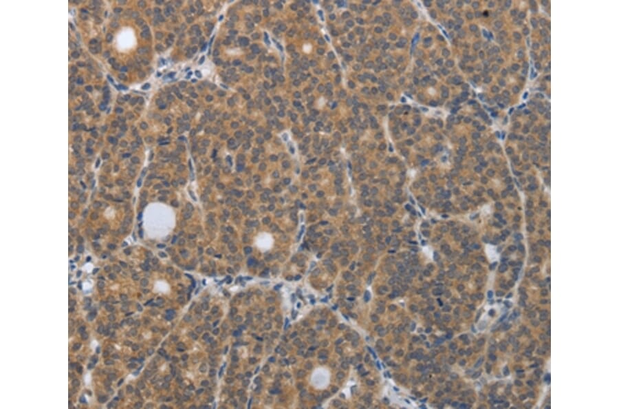 Immunohistochemistry - PGR Antibody from Signalway Antibody (37221) - Antibodies.com