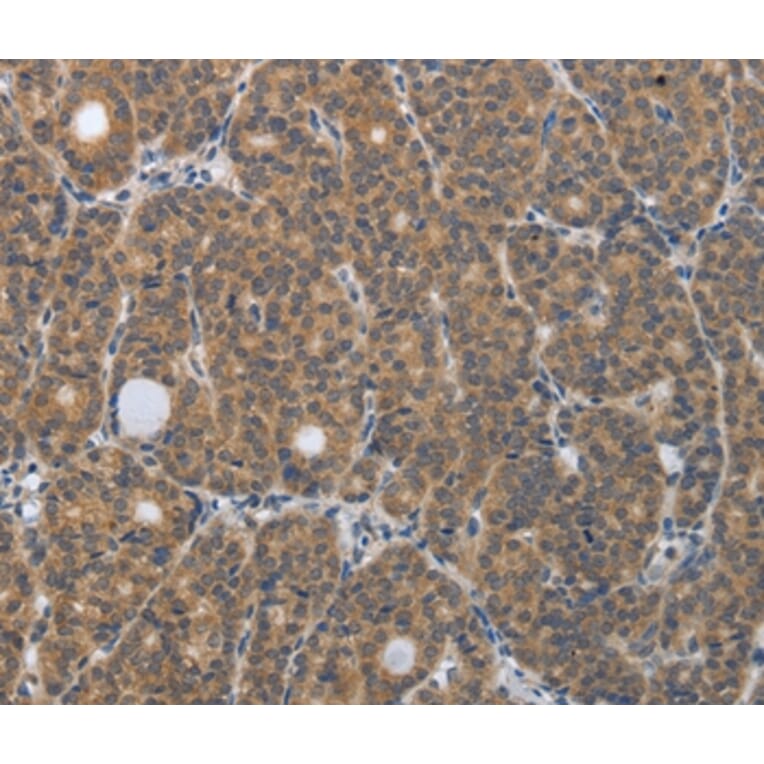 Immunohistochemistry - PGR Antibody from Signalway Antibody (37221) - Antibodies.com