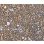 Immunohistochemistry - PGR Antibody from Signalway Antibody (37221) - Antibodies.com