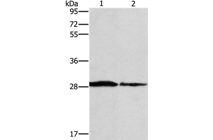 SPR Antibody from Signalway Antibody (37391) - Antibodies.com