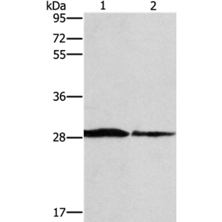 SPR Antibody from Signalway Antibody (37391) - Antibodies.com