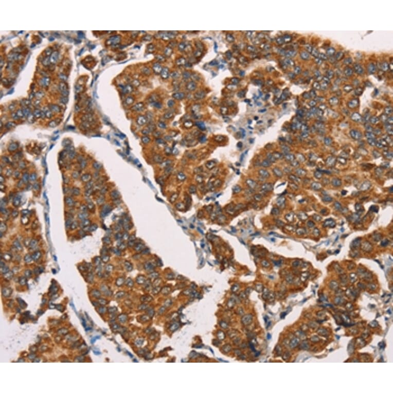 Immunohistochemistry - SPR Antibody from Signalway Antibody (37391) - Antibodies.com