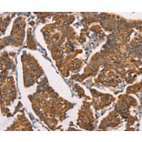 Immunohistochemistry - SPR Antibody from Signalway Antibody (37391) - Antibodies.com