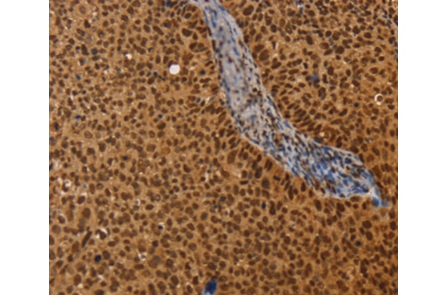 Immunohistochemistry - CEL Antibody from Signalway Antibody (37441) - Antibodies.com