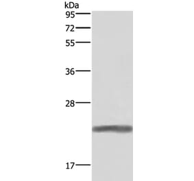 GH1 Antibody from Signalway Antibody (37591) - Antibodies.com