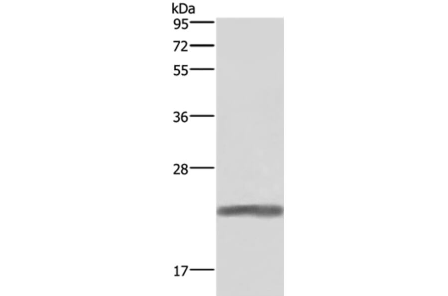 GH1 Antibody from Signalway Antibody (37591) - Antibodies.com