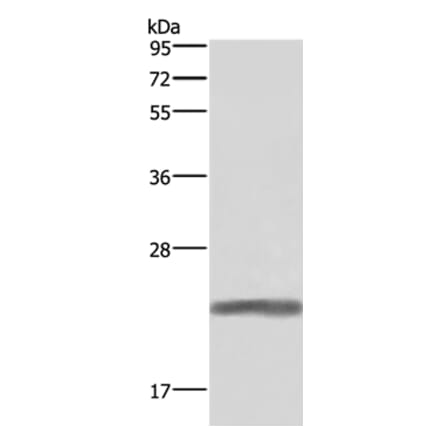 GH1 Antibody from Signalway Antibody (37591) - Antibodies.com