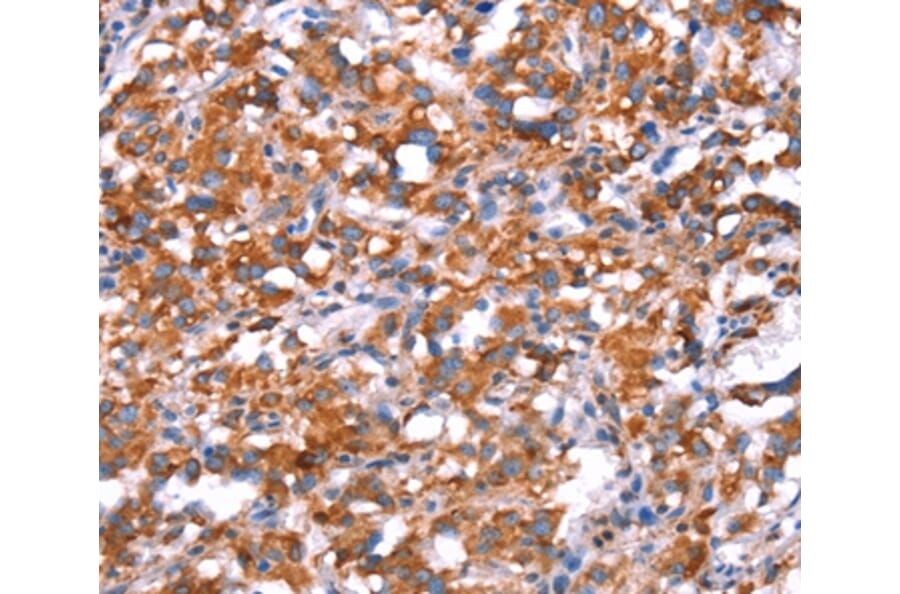 Immunohistochemistry - GH1 Antibody from Signalway Antibody (37591) - Antibodies.com
