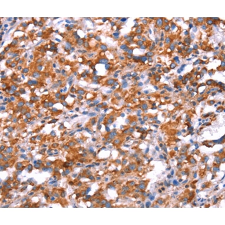 Immunohistochemistry - GH1 Antibody from Signalway Antibody (37591) - Antibodies.com
