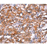 Immunohistochemistry - GH1 Antibody from Signalway Antibody (37591) - Antibodies.com