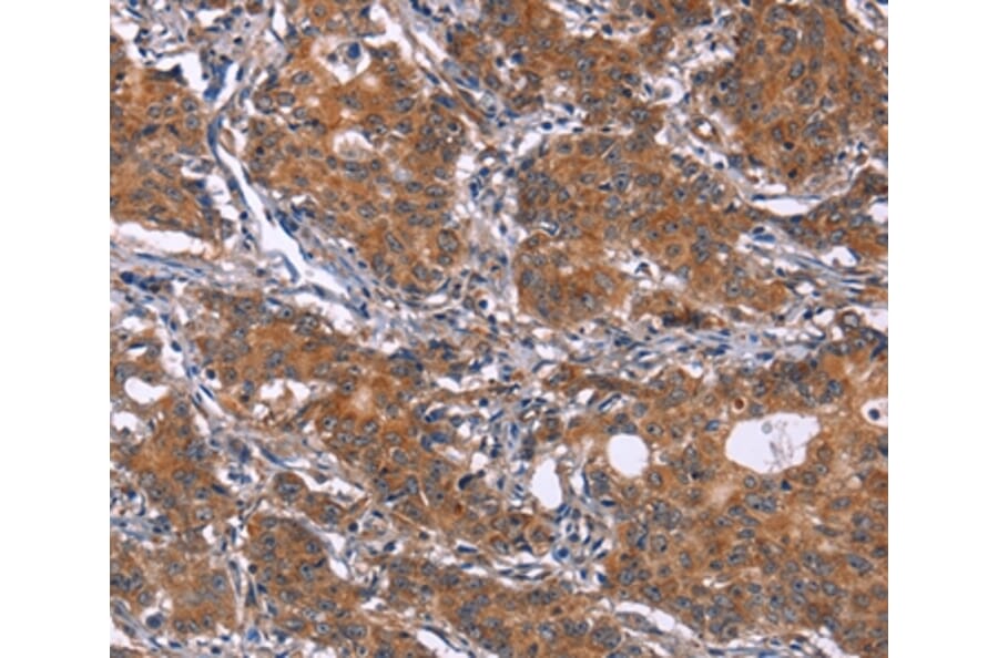 Immunohistochemistry - GLS Antibody from Signalway Antibody (37597) - Antibodies.com