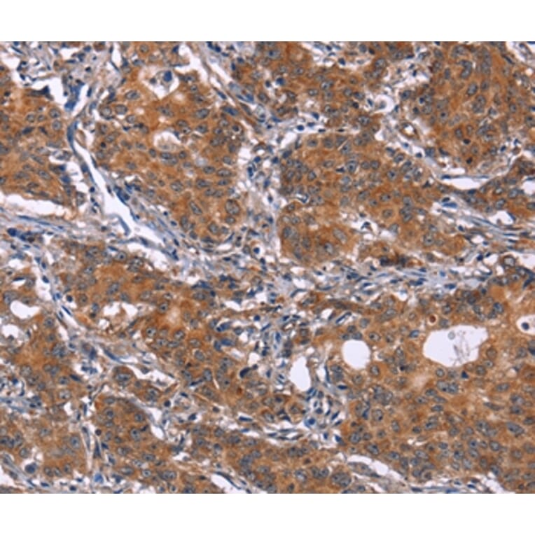 Immunohistochemistry - GLS Antibody from Signalway Antibody (37597) - Antibodies.com