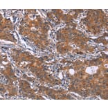 Immunohistochemistry - GLS Antibody from Signalway Antibody (37597) - Antibodies.com