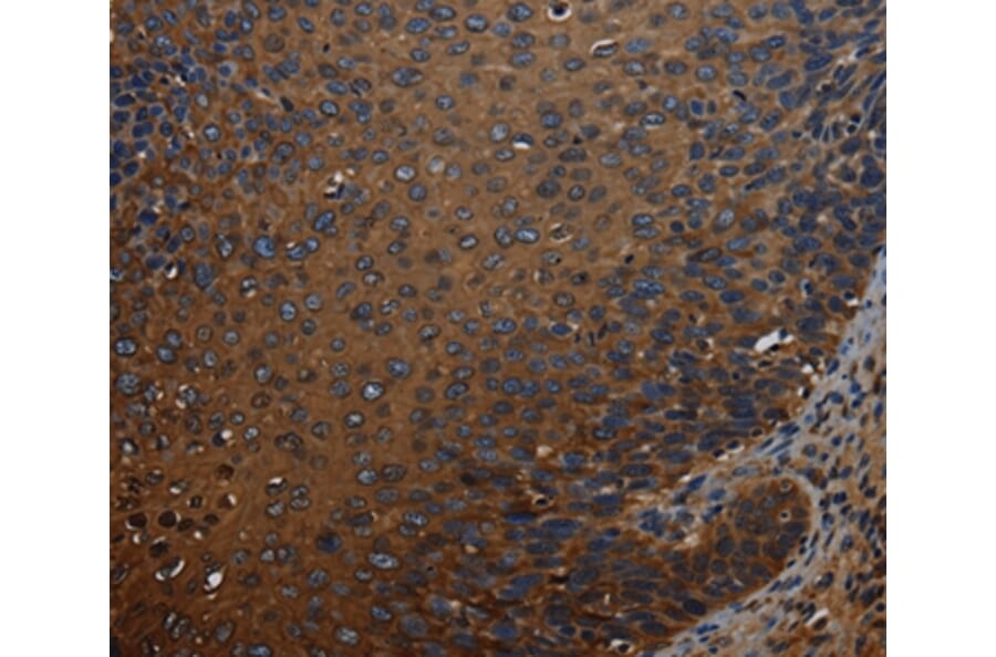 Immunohistochemistry - IVL Antibody from Signalway Antibody (37804) - Antibodies.com