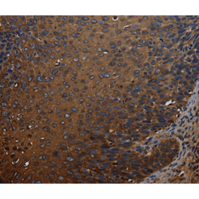 Immunohistochemistry - IVL Antibody from Signalway Antibody (37804) - Antibodies.com