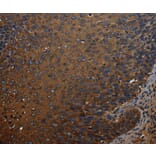 Immunohistochemistry - IVL Antibody from Signalway Antibody (37804) - Antibodies.com