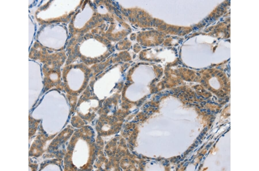 Immunohistochemistry - SCD Antibody from Signalway Antibody (37896) - Antibodies.com